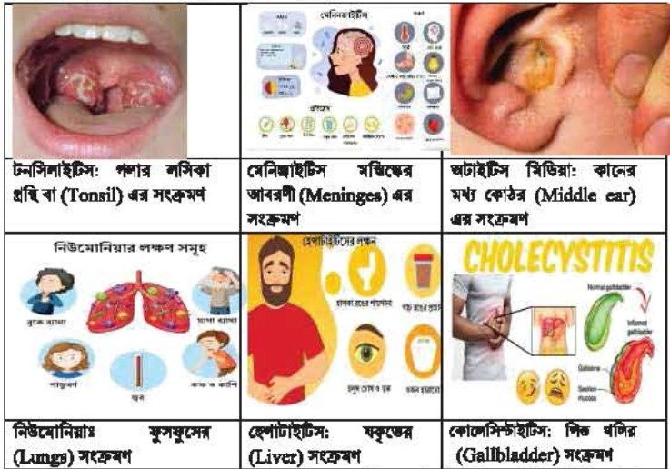 সংক্রামক বা ছোঁয়াচে রোগ