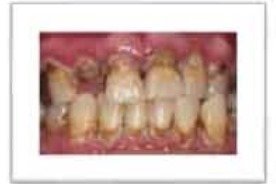 ওরাল হাইজিন