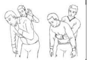 ফার্স্ট এইডের বিভিন্ন পদ্ধতি প্রয়োগ করা