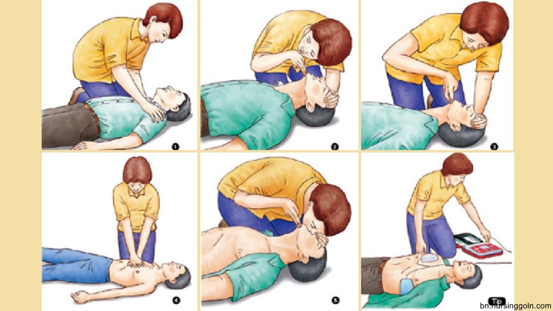 কার্ডিও পালমোনারী রিসাসিটেশন