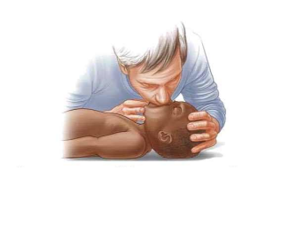 কার্ডিও পালমোনারী রিসাসিটেশন