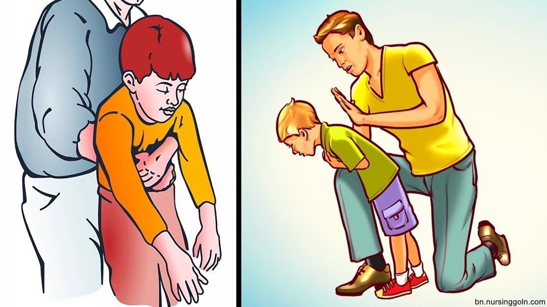 হেইমলিখ কৌশল