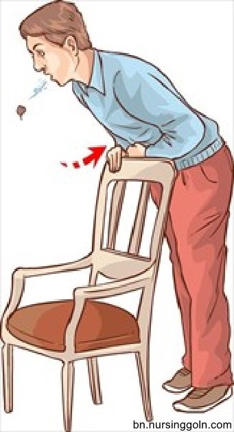 হেইমলিখ কৌশল