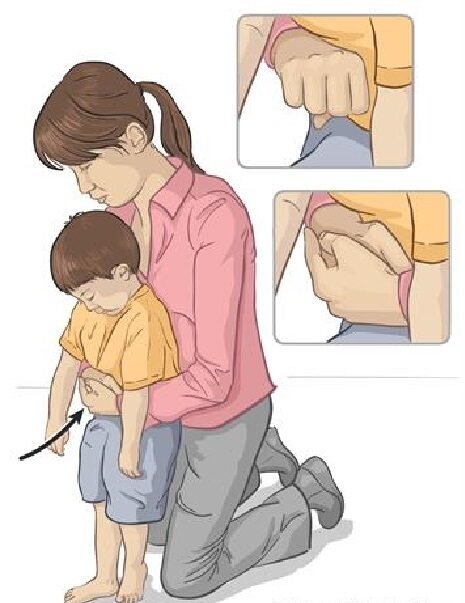 হেইমলিখ কৌশল