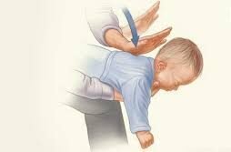 হেইমলিখ কৌশল