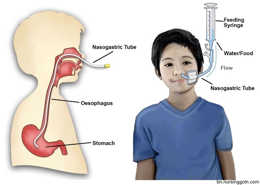 বিশেষ চাহিদা সম্পন্ন ব্যক্তির কেয়ার গিভিং অনুশীলনী