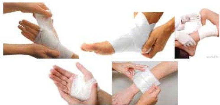 ক্ষত এর চিকিৎসা