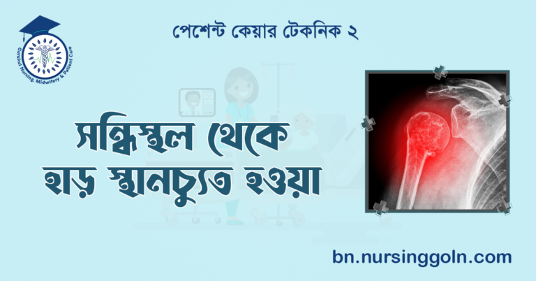 সন্ধিস্থল থেকে হাড় স্থানচ্যুত হওয়া